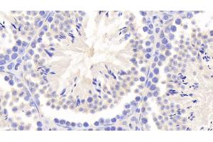 Detection of a1BG in Mouse Testis Tissue using Polyclonal Antibody to Alpha-1-B-Glycoprotein (a1BG)