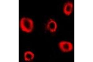 Immunofluorescent analysis of RRM2 staining in Hela cells.