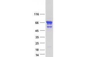 Validation with Western Blot