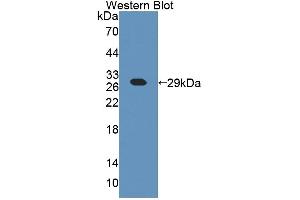 Detection of Recombinant CHN2, Mouse using Polyclonal Antibody to Chimerin 2 (CHN2) (CHN2 anticorps  (AA 101-323))