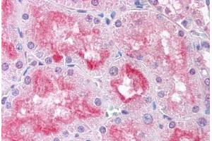 Human Kidney (formalin-fixed, paraffin-embedded) stained with USP33 antibody ABIN213600 at 5 ug/ml followed by biotinylated goat anti-rabbit IgG secondary antibody ABIN481713, alkaline phosphatase-streptavidin and chromogen.