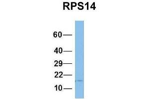 Host:  Rabbit  Target Name:  RPS14  Sample Type:  Human Fetal Brain  Antibody Dilution:  1. (RPS14 anticorps  (Middle Region))