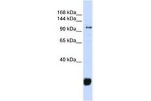 Image no. 1 for anti-F-Box Protein 10 (FBXO10) (AA 324-373) antibody (ABIN6743262) (FBXO10 anticorps  (AA 324-373))
