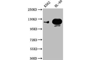 Western Blot Positive WB detected in: K562 whole cell lysate,HL-60 whole cell lysate All lanes: POTEE antibody at 1:1000 Secondary Goat polyclonal to rabbit IgG at 1/50000 dilution Predicted band size: 122 kDa Observed band size: 122 kDa