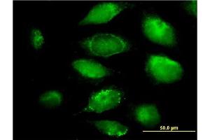 Immunofluorescence of monoclonal antibody to PLGLB2 on HeLa cell. (PLGLB2 anticorps  (AA 21-96))