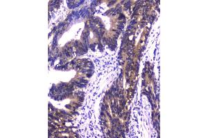 IHC analysis of PPID using anti-PPID antibody (ABIN6719438). (PPID anticorps  (AA 306-370))