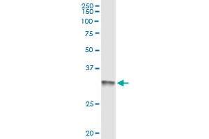 anti-mRNA Turnover 4 Homolog (MRTO4) (AA 1-239) antibody
