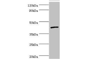 Western blot All lanes: Interleukin-13 receptor subunit alpha-2 antibody at 5 μg/mL + Hela whole cell lysate Secondary Goat polyclonal to rabbit IgG at 1/10000 dilution Predicted band size: 44 kDa Observed band size: 44 kDa (IL13RA2 anticorps  (AA 27-343))
