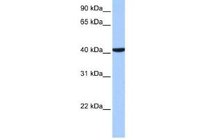 WB Suggested Anti-CC2D1B Antibody Titration: 0. (CC2D1B anticorps  (C-Term))