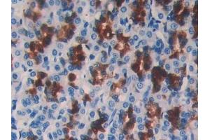Detection of CSTB in Rat Stomach Tissue using Monoclonal Antibody to Cystatin B (CSTB)