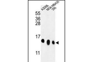 Western blot analysis of RPL36 Antibody (N-term) (ABIN653584 and ABIN2842958) in , MDA-M, 293 cell line lysates (35 μg/lane). (RPL36 anticorps  (N-Term))