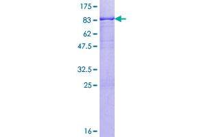 Image no. 1 for PBX/knotted 1 Homeobox 1 (PKNOX1) (AA 1-436) protein (GST tag) (ABIN1315244)