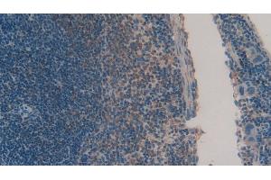 Detection of CHEM in Mouse Spleen Tissue using Polyclonal Antibody to Chemerin (CHEM) (Chemerin anticorps  (AA 21-155))