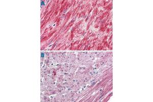 Immunohistochemistry (Formalin/PFA-fixed paraffin-embedded sections) of human prostate, smooth muscle (A) and human colon, smooth muscle (B) with ELTD1 polyclonal antibody . (ELTD1 anticorps  (N-Term))
