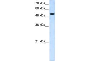 Western Blotting (WB) image for anti-Solute Carrier Family 25 (Mitochondrial Carrier, Phosphate Carrier), Member 25 (SLC25A25) antibody (ABIN2462730) (SLC25A25 anticorps)