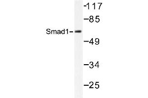 Image no. 2 for anti-SMAD, Mothers Against DPP Homolog 1 (SMAD1) antibody (ABIN272123) (SMAD1 anticorps)