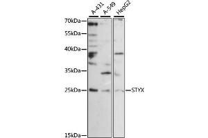 Western blot analysis of extracts of various cell lines, using STYX antibody (ABIN6293959) at 1:1000 dilution.