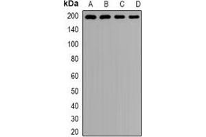 Western blot analysis of Clathrin Heavy Chain expression in Hela (A), MCF7 (B), mouse lung (C), rat brain (D) whole cell lysates. (Clathrin Heavy Chain (CLTC) anticorps)