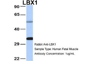 Host: Rabbit Target Name: LBX1 Sample Type: Human Fetal Muscle Antibody Dilution: 1. (Lbx1 anticorps  (Middle Region))