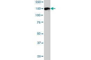 DDEF1 monoclonal antibody (M01), clone 2G7 Western Blot analysis of DDEF1 expression in IMR-32 .