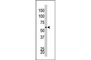 The DYRK4 polyclonal antibody  is used in Western blot to detect DYRK4 in Jurkat cell lysate.