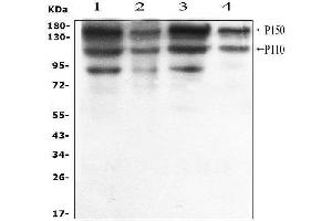 Western blot analysis of ADAR1 using anti-ADAR1 antibody (ABIN4886426). (ADAR anticorps  (AA 128-346))