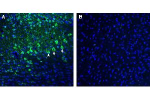Expression of CART in mouse parietal cortex.