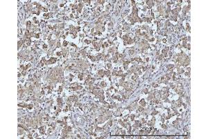 IHC analysis of ODF2L using anti-ODF2L antibody (ABIN7601202). (ODF2L anticorps  (AA 3-610))