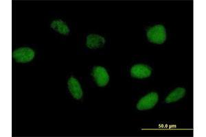Immunofluorescence of purified MaxPab antibody to TAF6L on HeLa cell. (TAF6L anticorps  (AA 1-459))