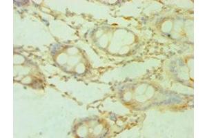 Immunohistochemistry of paraffin-embedded human colon tissue using ABIN7168889 at dilution of 1:100 (SHMT1 anticorps  (AA 324-483))