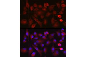 Immunofluorescence analysis of A-549 cells using NOX5 Rabbit pAb (ABIN6133125, ABIN6144754, ABIN6144755 and ABIN6222951) at dilution of 1:100 (40x lens). (NOX5 anticorps  (AA 661-765))