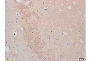 Formalin-fixed and paraffin embedded rat brain labeled with Anti--LIS1 Polyclonal Antibody, Unconjugated (ABIN676868) at 1:200, followed by conjugation to the secondary antibody and DAB staining (PAFAH1B1 anticorps  (AA 311-410))