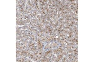 Immunohistochemical staining (Formalin-fixed paraffin-embedded sections) of human liver with MRPS18A polyclonal antibody  shows moderate positivity in hepatocytes.
