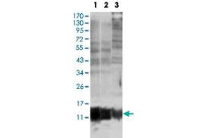 Western blot analysis of S100A10 monoclonal antobody, clone 4E7E10  against MCF-7 (1), HepG2 (2) and HeLa (3). (S100A10 anticorps)