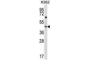 KRT12 Antibody (C-term) western blot analysis in K562 cell line lysates (35µg/lane). (KRT12 anticorps  (C-Term))