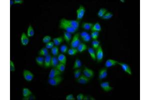 Immunofluorescence staining of Hela cells with ABIN7152990 at 1:133, counter-stained with DAPI. (FOLR2 anticorps  (AA 35-167))