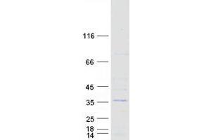 Validation with Western Blot