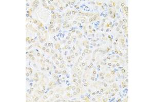 Immunohistochemistry of paraffin-embedded mouse kidney using SUMO1 Antibody (ABIN5971157) at dilution of 1/200 (40x lens). (SUMO1 anticorps)