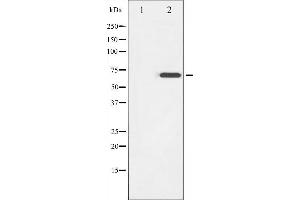 Western blot analysis of ZAP-70 phosphorylation expression in Jurkat whole cell lysates,The lane on the left is treated with the antigen-specific peptide. (ZAP70 anticorps  (pTyr319))
