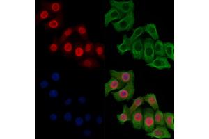 Phospho-MCM2 (Ser108) Antibody staining Hela cells(heat shock treatment) by IF/ICC. (MCM2 anticorps  (pSer108))