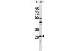 Western Blotting (WB) image for anti-FOS-Like Antigen 2 (FOSL2) antibody (ABIN2998778) (FOSL2 anticorps)
