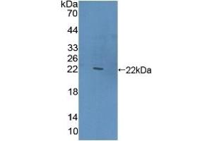 Detection of Recombinant CLEC10A, Human using Polyclonal Antibody to Cluster Of differentiation 301 (CD301) (CLEC10A anticorps  (AA 71-239))