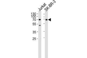 Western Blotting (WB) image for anti-CD46 (CD46) antibody (ABIN3002132) (CD46 anticorps)