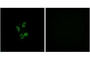 Immunofluorescence analysis of HuvEc cells, using Cytochrome P450 4Z1 Antibody. (CYP4Z1 anticorps  (AA 71-120))