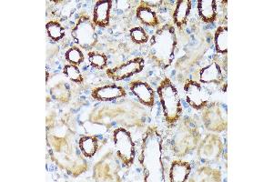 Immunohistochemistry of paraffin-embedded rat kidney using W/W/W Rabbit mAb (ABIN7271346) at dilution of 1:100 (40x lens). (WASF2 anticorps)