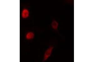 ABIN6276550 staining HeLa cells by IF/ICC. (NEUROD1 anticorps  (N-Term))