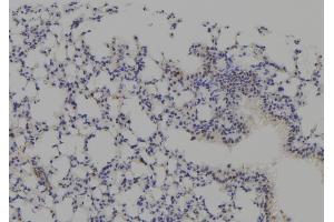 ABIN6277771 at 1/100 staining Mouse lung tissue by IHC-P.