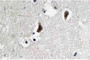 Immunohistochemistry (IHC) analyzes of c-Src antibody in paraffin-embedded human brain tissue. (NCOA1 anticorps)