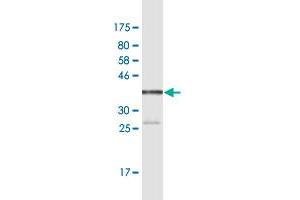 Western Blot detection against Immunogen (37.