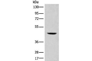 Western blot analysis of 293T cell lysate using SHPK Polyclonal Antibody at dilution of 1:500 (SHPK anticorps)